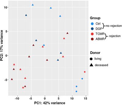 Can Gene Expression Analysis in Zero-Time Biopsies Predict Kidney Transplant Rejection?